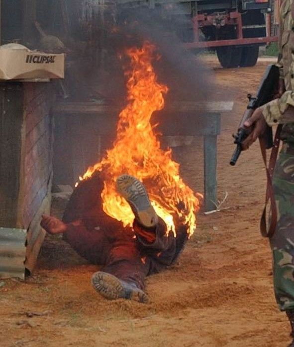 A full-body fire burn on a township set, flames rising from the performer